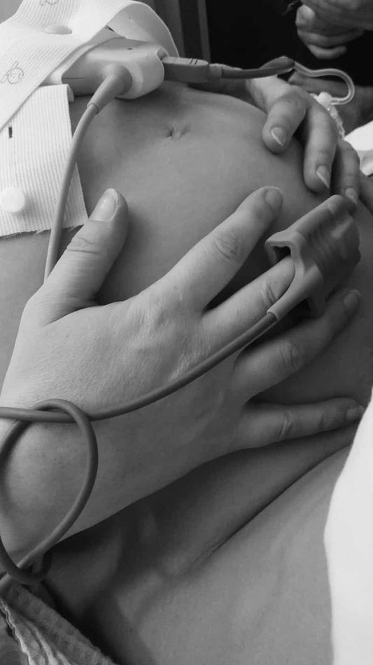 zwart wit afbeelding van zwangere buik met handen moeder en de kabels van meetinstrumenten